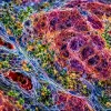 ИИ научат читать опухоли по расположению клеток: создан крупнейший атл…